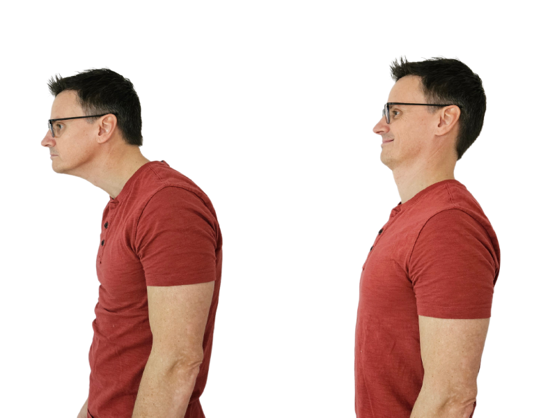 تشخیص قوز گردن، از معاینه تا ارزیابی حرکتی